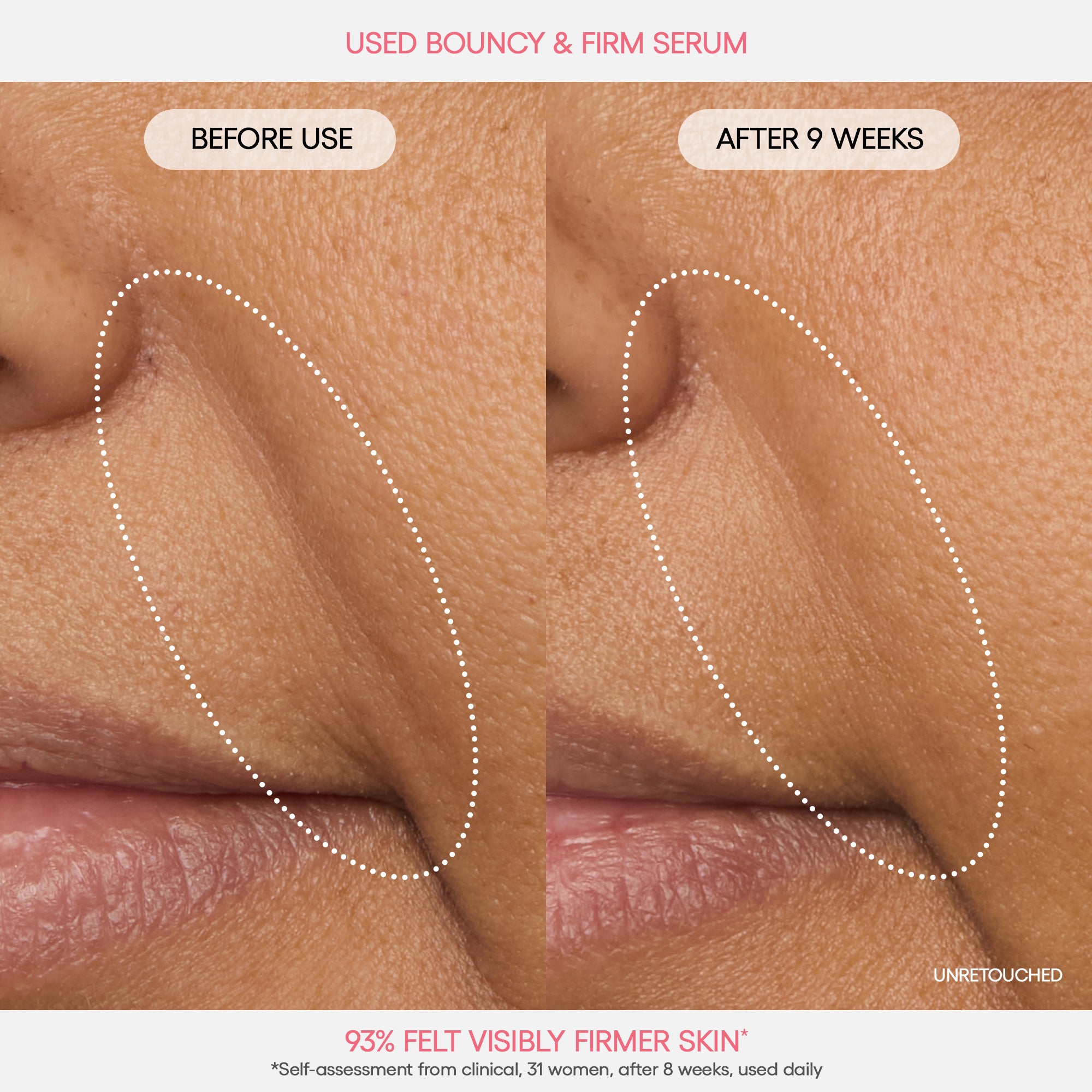 Alternative view of Bouncy u0026 Firm Serum