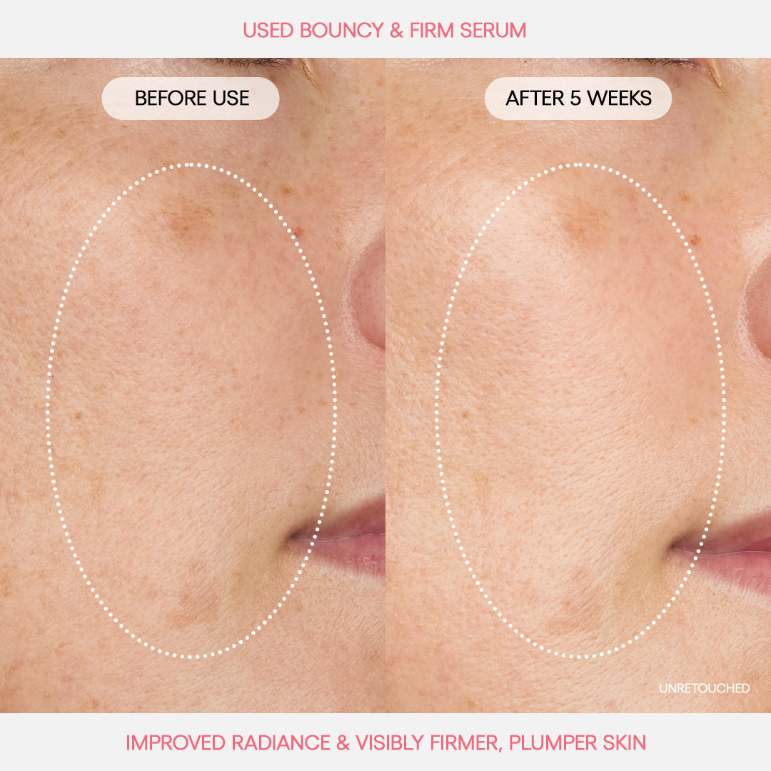 Free Bouncy u0026 Firm Serum - Image 3